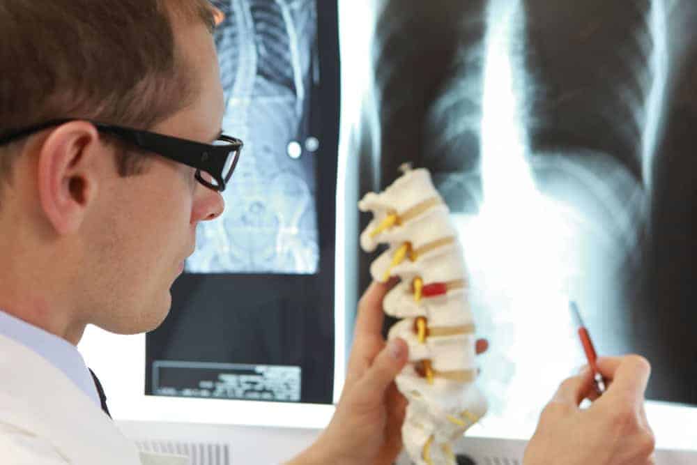 A doctor wearing glasses examines a spine model in front of an X-ray display showing a chest X-ray. Holding a pen, he points at the model, possibly assessing spinal alignment as part of pain management NYC strategies.